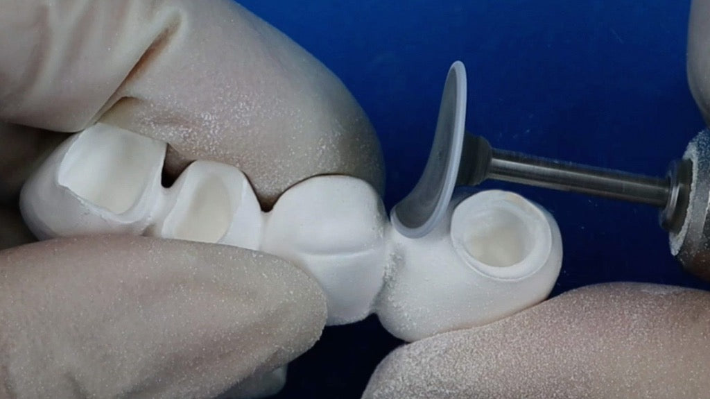 Initial Zirconia Processing Kit