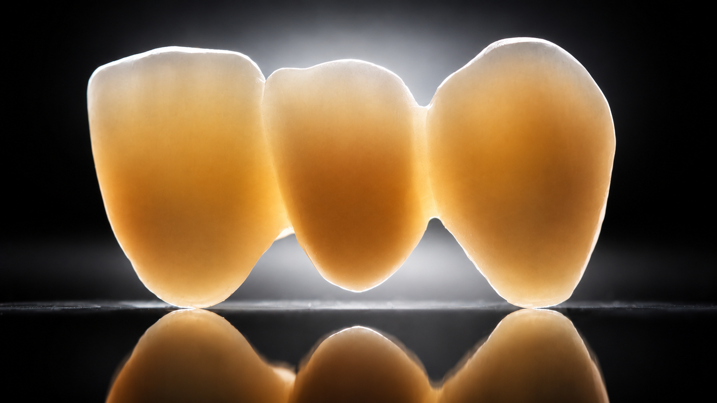CopraHyperion MD PRO 65/40 – Für die Speed-Sinterung geeigneter Zirkonoxidblock für CEREC - Packung mit einem Block